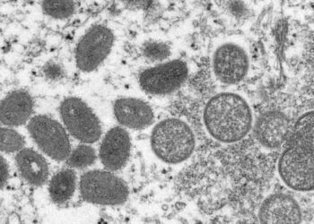 monkeypox e1656507662812