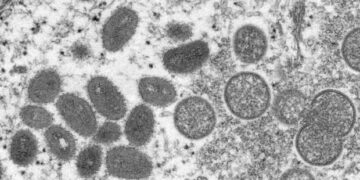 monkeypox e1656507662812