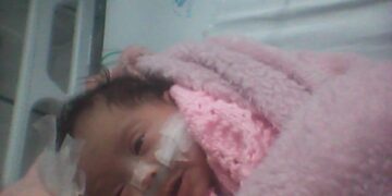 Menina Hospital Portao rotated